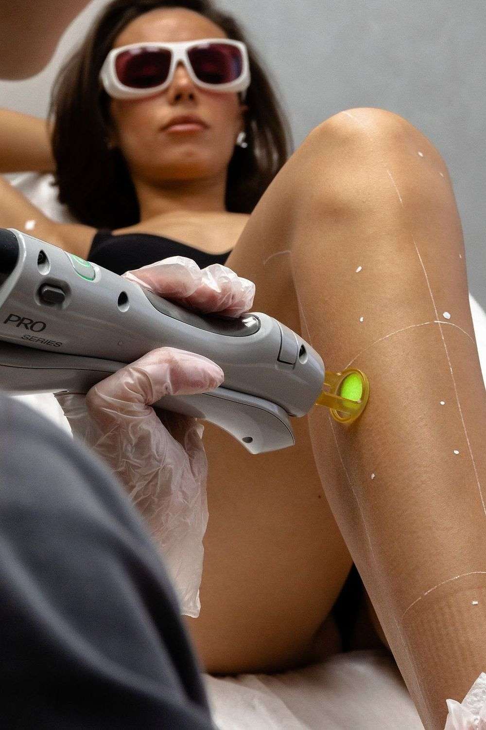 Photo Les questions que tout le monde se pose sur l&rsquo;&eacute;pilation laser 